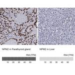 NPM2 Antibody