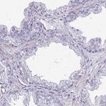 PLA2G4E Antibody in Immunohistochemistry (Paraffin) (IHC (P))