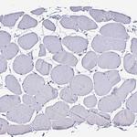 PLA2G4E Antibody in Immunohistochemistry (Paraffin) (IHC (P))