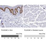 PLA2G4E Antibody in Immunohistochemistry (IHC)