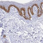 PLA2G4E Antibody in Immunohistochemistry (IHC)