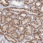 CP045 Antibody in Immunohistochemistry (Paraffin) (IHC (P))