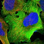 TRMT1 Antibody in Immunocytochemistry (ICC/IF)