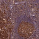 TRMT1 Antibody in Immunohistochemistry (Paraffin) (IHC (P))