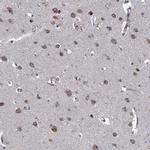 CTU2 Antibody in Immunohistochemistry (IHC)