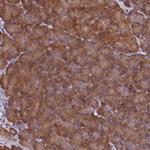 KCC1 Antibody in Immunohistochemistry (Paraffin) (IHC (P))