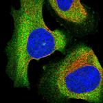 EPS8L2 Antibody in Immunocytochemistry (ICC/IF)