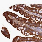 EPS8L2 Antibody in Immunohistochemistry (IHC)