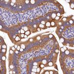 EPS8L2 Antibody in Immunohistochemistry (IHC)