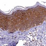 EPS8L2 Antibody in Immunohistochemistry (IHC)