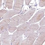 EPS8L2 Antibody in Immunohistochemistry (IHC)