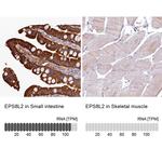 EPS8L2 Antibody