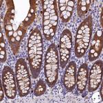 EPS8L2 Antibody in Immunohistochemistry (IHC)