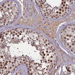 MCAF2 Antibody in Immunohistochemistry (IHC)