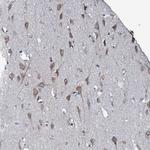 EDC4 Antibody in Immunohistochemistry (Paraffin) (IHC (P))