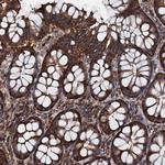 EDC4 Antibody in Immunohistochemistry (Paraffin) (IHC (P))