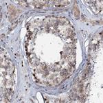 EDC4 Antibody in Immunohistochemistry (Paraffin) (IHC (P))