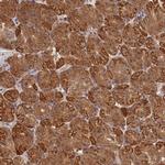 Katanin p80 Antibody in Immunohistochemistry (IHC)