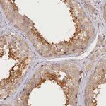 Katanin p80 Antibody in Immunohistochemistry (IHC)