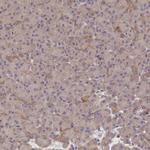 Katanin p80 Antibody in Immunohistochemistry (IHC)