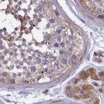 AMDHD2 Antibody in Immunohistochemistry (IHC)