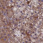 AMDHD2 Antibody in Immunohistochemistry (IHC)