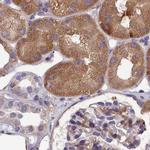 AMDHD2 Antibody in Immunohistochemistry (IHC)