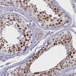 MCAF2 Antibody in Immunohistochemistry (Paraffin) (IHC (P))