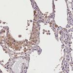 OAS3 Antibody in Immunohistochemistry (Paraffin) (IHC (P))