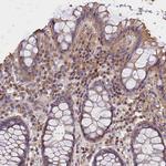 OAS3 Antibody in Immunohistochemistry (Paraffin) (IHC (P))