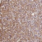 beta Actin Antibody in Immunohistochemistry (IHC)