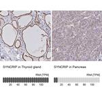 HnRNP Q Antibody in Immunohistochemistry (IHC)