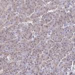 HnRNP Q Antibody in Immunohistochemistry (IHC)