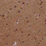 BICD1 Antibody in Immunohistochemistry (Paraffin) (IHC (P))