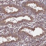 BICD1 Antibody in Immunohistochemistry (Paraffin) (IHC (P))