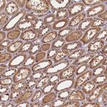 BICD1 Antibody in Immunohistochemistry (Paraffin) (IHC (P))