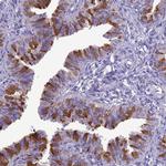 BBS2 Antibody in Immunohistochemistry (Paraffin) (IHC (P))