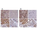 AMDHD2 Antibody in Immunohistochemistry (IHC)