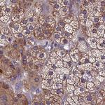 AMDHD2 Antibody in Immunohistochemistry (IHC)