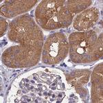 AMDHD2 Antibody in Immunohistochemistry (IHC)