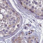 AMDHD2 Antibody in Immunohistochemistry (IHC)