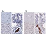 CYP51A1 Antibody in Immunohistochemistry (IHC)