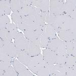 CYP51A1 Antibody in Immunohistochemistry (IHC)