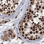 ZC3H18 Antibody in Immunohistochemistry (IHC)