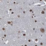 ZC3H18 Antibody in Immunohistochemistry (IHC)