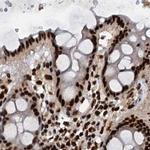 ZC3H18 Antibody in Immunohistochemistry (IHC)