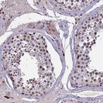 RNF40 Antibody in Immunohistochemistry (Paraffin) (IHC (P))