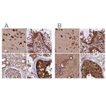 KARS Antibody in Immunohistochemistry (IHC)