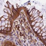 KARS Antibody in Immunohistochemistry (IHC)