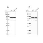 KARS Antibody in Western Blot (WB)